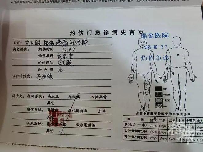 事发上海市中心！小伙口袋里充电宝突然起火被严重烧伤！又是这个知名品牌官方最新披露：违反规定虚假宣传(图3)